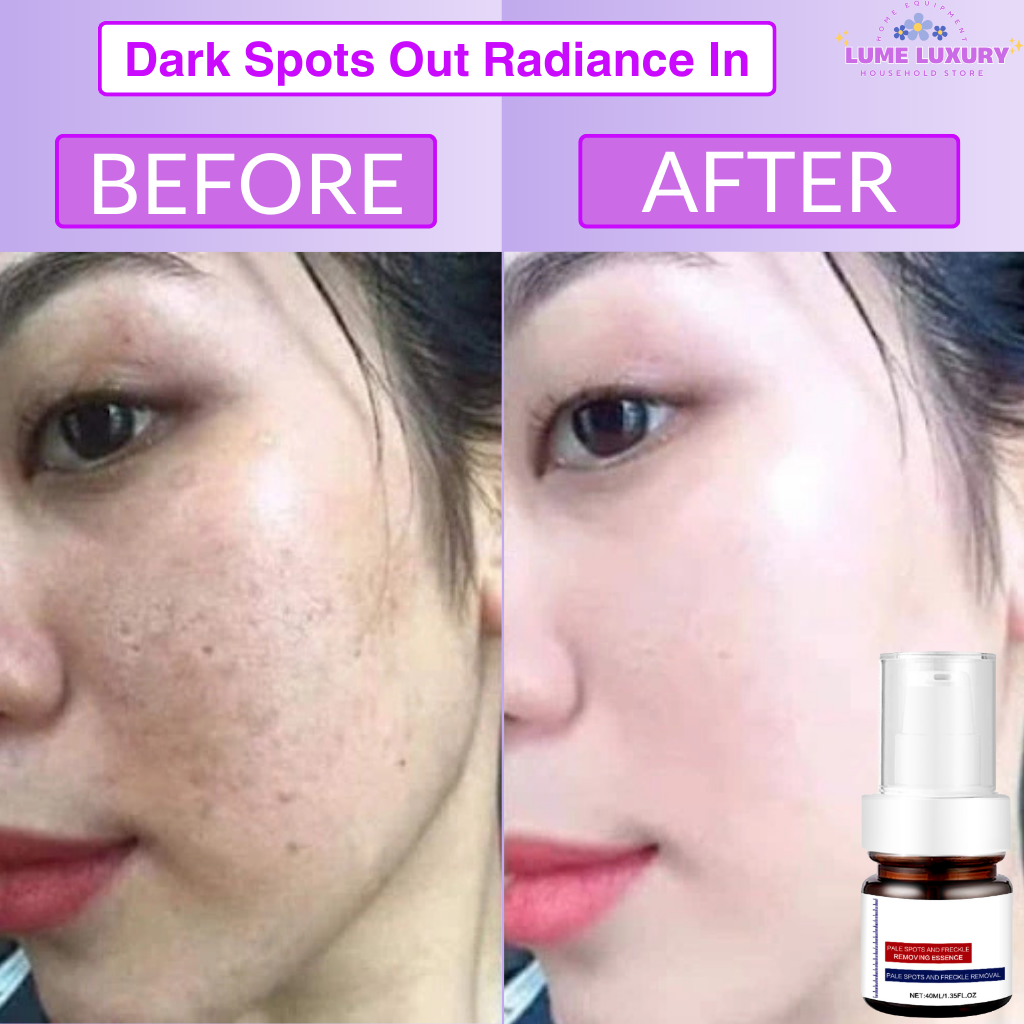 Meladin Advanced Bright – Deep Repair for Melasma & Sun Damage
