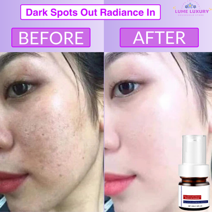 Meladin Advanced Bright – Deep Repair for Melasma & Sun Damage